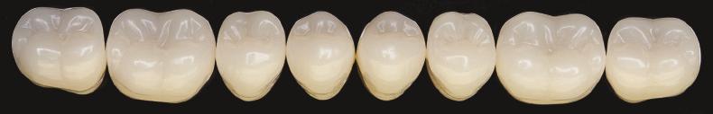 Denti Posteriori 28.1 Le Forme Posteriori 4natur P1 29.