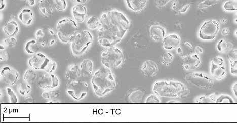 SLS La formula del successo. La leucite è l anima della ceramica dentale.