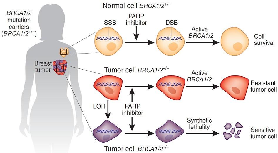 TNBC