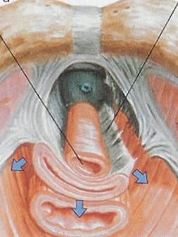 Continenza urinaria: la vagina