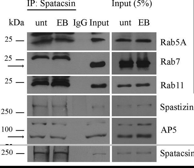 Spatacsin AP5 Rab11 Spastizin Spatacsin AP5