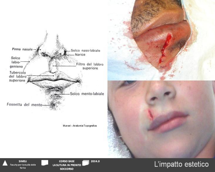 CORSO: LA FERITA E