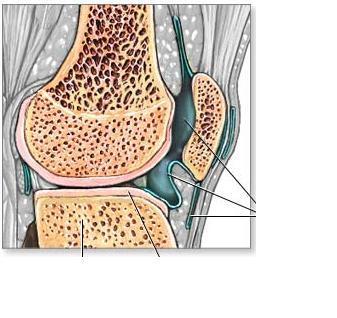 mono- oligoarticolae che coinvolge arti inferiori 1) Infezione gastrointestinale (Yersinia, Salmonella, Shigella, Campylobacter), respiratoria (