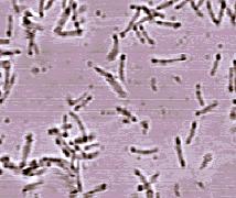 degradazione di clorurati organici Desulfitobacterium Dehalobacter Preparazione e utilizzazione di sonde geniche per monitorare i batteri degradativi in siti