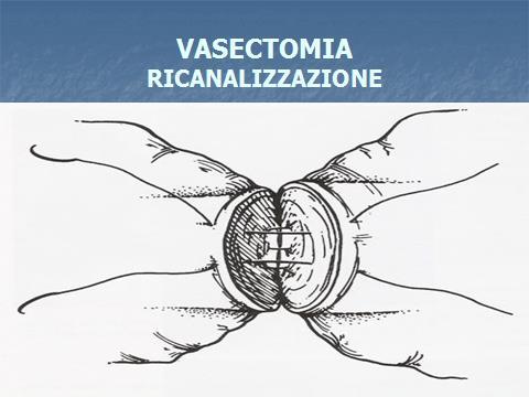 STRESS OSSIDATIVO SEMINALE PREVENZIONE Individuazione e rimozione fattori di rischio Ottimizzare lo stile di vita