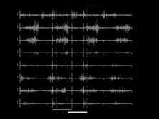 21/3/7 Il segnale elettromiografico EMG: segnale interferenziale Strumenti per la misura dei segnali elettromiografici T A Sol Ga M Ga L Va M SM BF Gl M Aspetti critici dell EMG configurazione degli