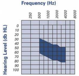 alla frequenza ed intensità con la quale il magnete vibra, l FMT ha la capacità di generare differenti suoni.