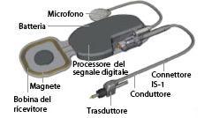 batteria, processore digitale e magnete; 2.