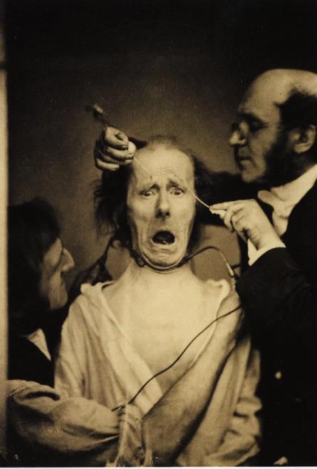 1853: Guillème Benjamin Duchenne, studio della mimica facciale in soggetti catalettici: 1863: Czermak, i battiti del polso: su un arteria viene applicato un bottone