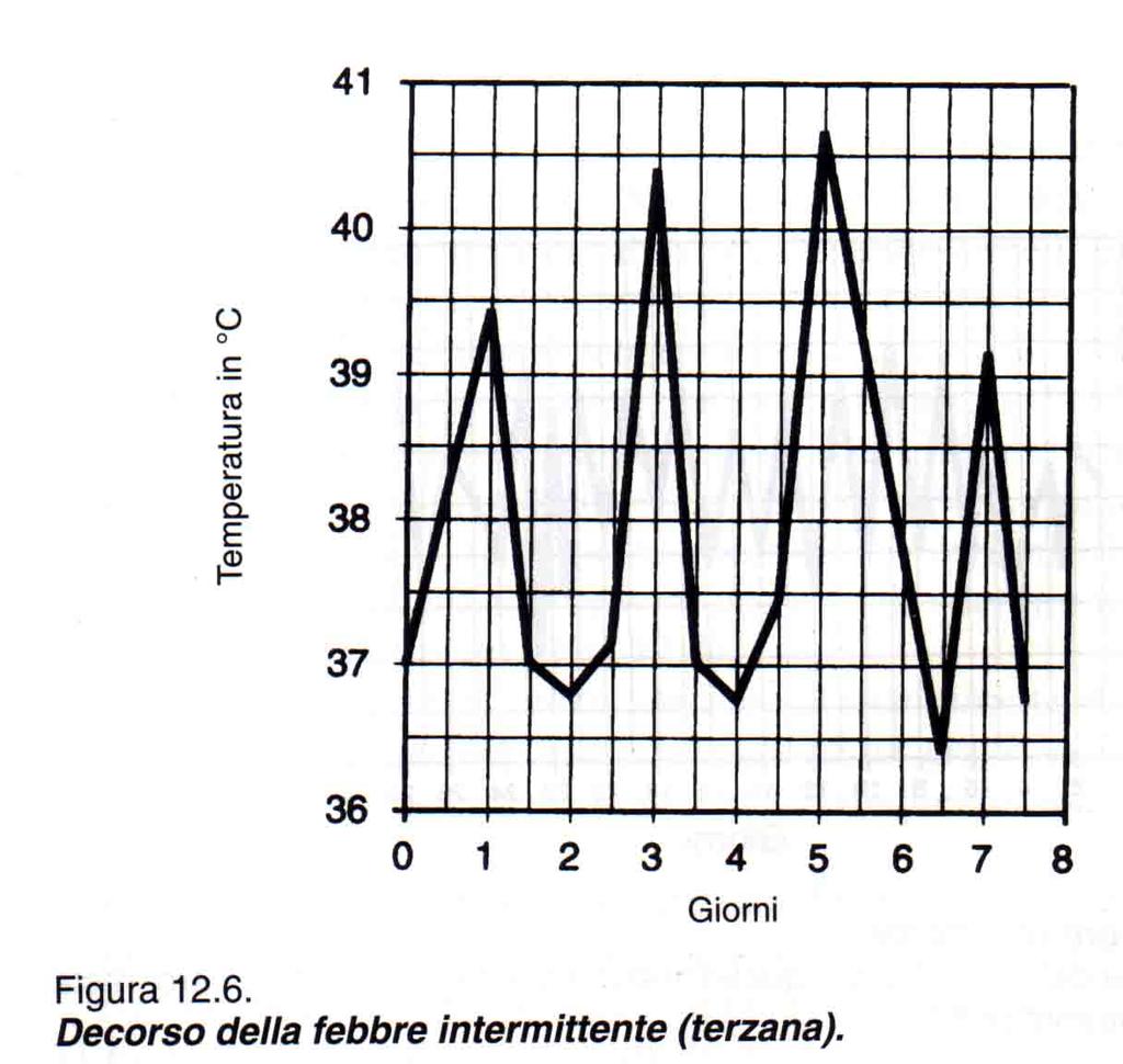 Febbre intermittente: si hanno dei picchi ipertermici alternati a fasi (ore o giorni) di apiressia (assenza di febbre): nella malaria a seconda dell agente eziologico (plasmodium)