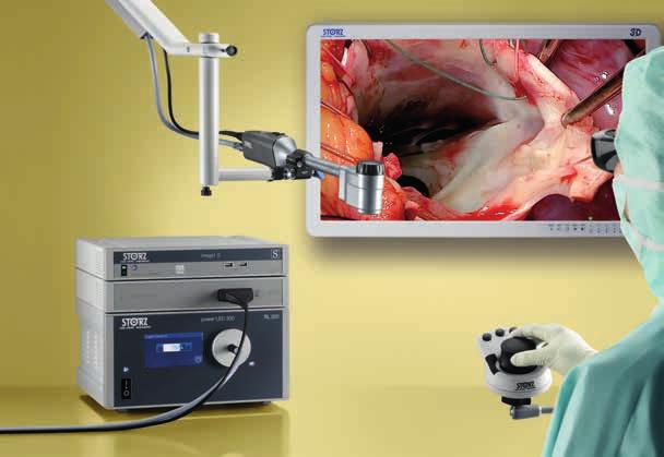 VITOM 3D Visualizzazione 3D per la cardiochirurgia aperta Il sistema VITOM 3D rappresenta una soluzione rivoluzionaria per la visualizzazione di interventi microchirurgici e di chirurgia aperta in