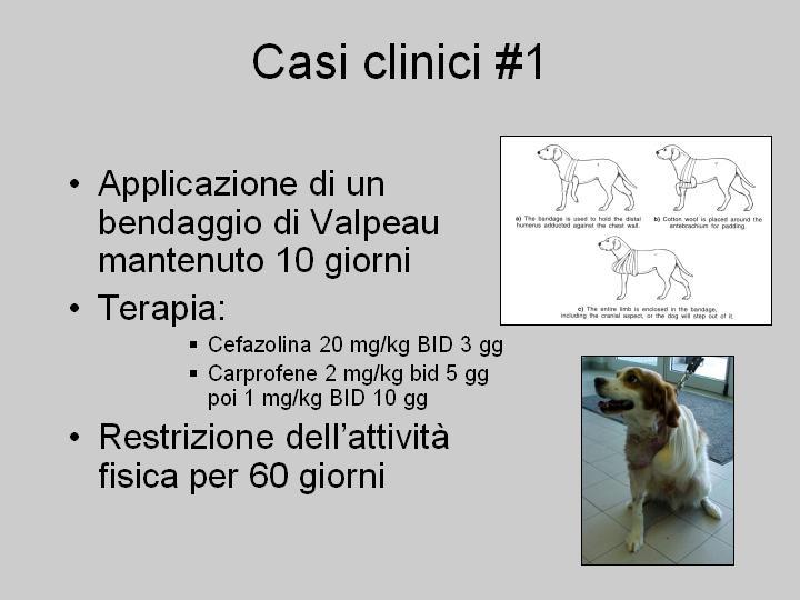 Trattamento Caso acuto Anestesia Riduzione a cielo chiuso Bendaggio di