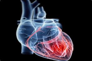 Appropriatezza chirurgica in ginecologia: cisti ovariche Menopause below both age 40 and 45 was associated with an increased risk of ischaemic heart disease, seeming most pronounced for women who had