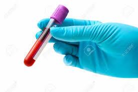 AMH levels and antral follicle count before/after surgery