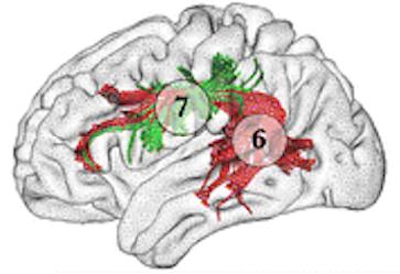 Le connessioni fronto-corticali Fascicolo arcuato segmento lungo fronto-temporale (6): pars opercularis (i.e., Broca area, BA44) corteccia uditiva (BA22) e la porzione posteriore del