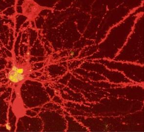Brain Cell Universe Il cervello umano è formato da più di 100 miliardi