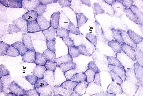 Cellule con pochi mitocondri Pochi mitocondri si trovano in cellule che operano