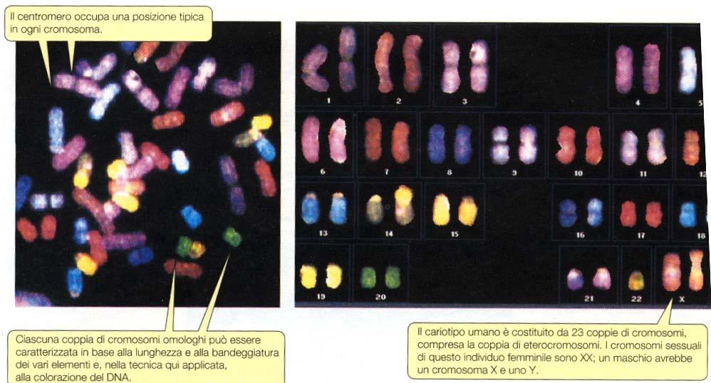 Le cellule umane sono provviste di 46 cromosomi- Le fotografie si riferiscono a cromosomi umani durante la metafase mitotica.