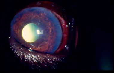 Lesioni oculari Azione diretta