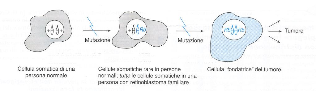 Ipotesi dei due stadi di Knudson Retinoblastoma (MIM 180200) raro e aggressivo tumore infantile che colpisce la retina (gene RB1, 13q14; 1/15.