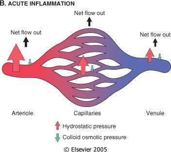 consta di due componenti principali: Reazione vascolare Reazione cellulare Vasocostrizione transitoria Vasodilatazione Aumento della permeabilità vascolare del microcircolo (fuoriuscita di liquidi e