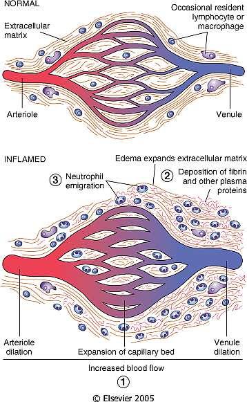 alterazioni volte ad aumentare al massimo la migrazione delle proteine plasmatiche e delle cellule circolanti fuori dalla circolazione e nella sede di lesione o infezione Modificazioni vascolari