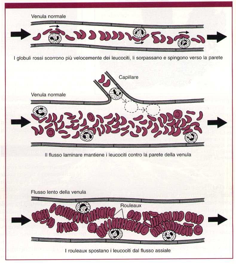 Stasi: il flusso è rallentato per aumento della concentrazione di globuli rossi nei piccoli vasi ed aumento della
