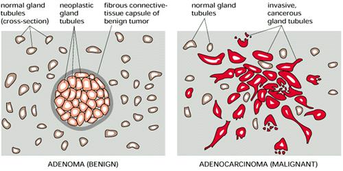 Le cellule tumorali vengono definite sulla base di due caratteristiche: 1.