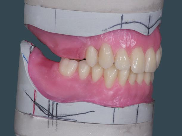 anatomica delle parti gengivali.