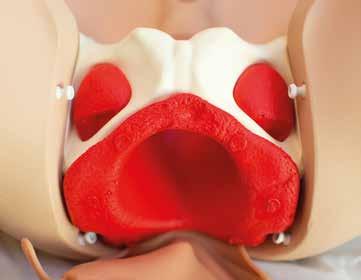 Inserto pelvico L inserto pelvico (rosso, vedere la Figura 13) non una rappresentazione accurata delle strutture anatomiche nel bacino, ma garantisce il corretto posizionamento dell unità vaginale.