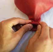 Ruotare l estremità aperta del palloncino dell utero all indietro fino a quando la parte centrale in schiuma e la superficie con velcro diventano