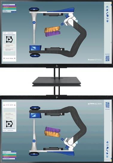 Durante il processo di scansione il modello viene trasferito dall articolatore reale nel software conservando la relazione degli assi.