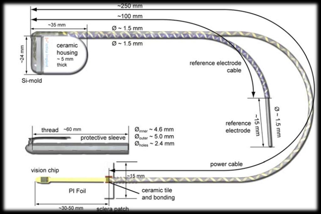 Schema