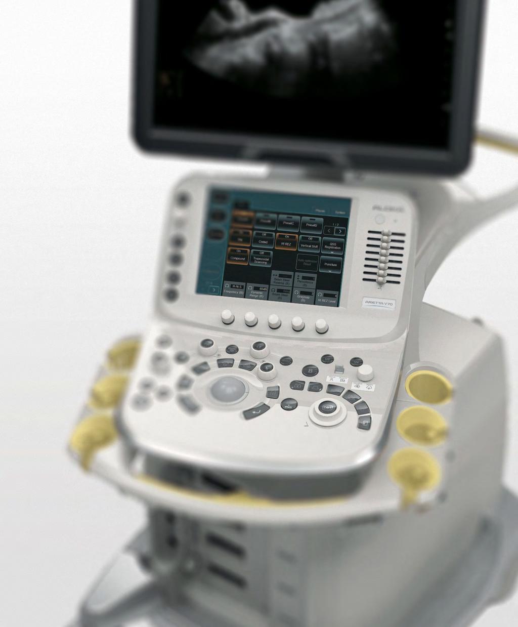 Le tecnologie per l'imaging Clearly Defined, in ARIETTA V70, sono alla base della straordinaria qualità delle immagini diagnostiche prodotte Le prestazioni cliniche di un sistema diagnostico a