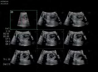 tra madre e figlio L'imaging a tre e quattro dimensioni può giocare un ruolo fondamentale in quanto strumento di comunicazione prenatale che consente di mettere in