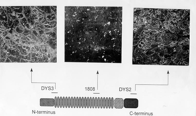 Anticorpi anti-distrofina DYS3