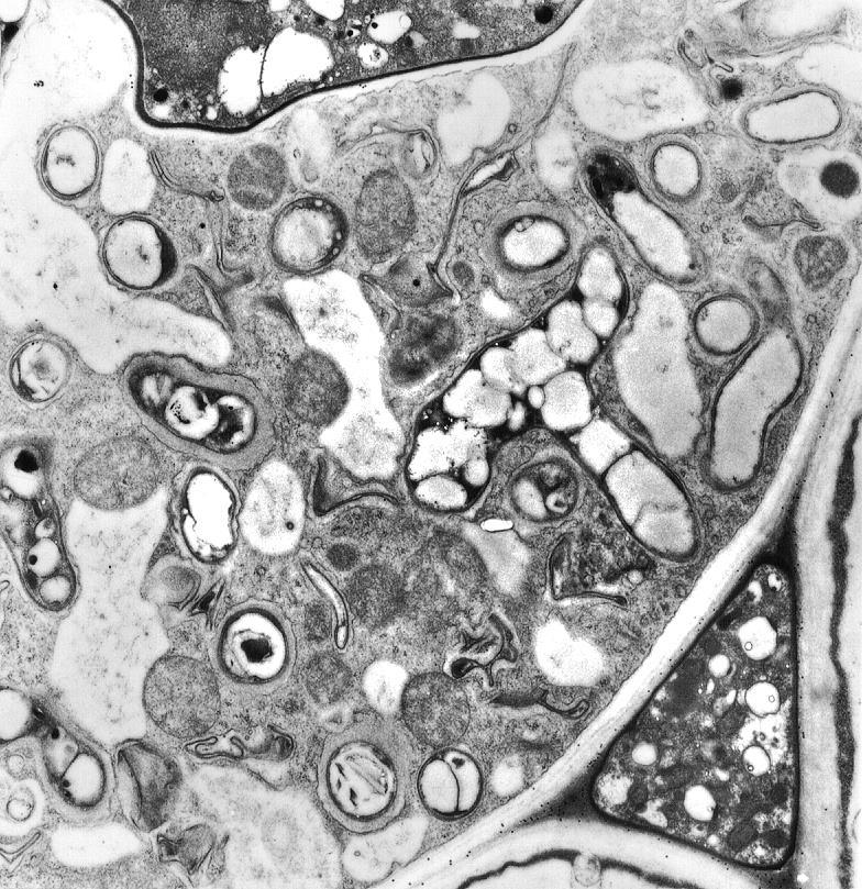 periarbuscolare) L arbuscolo: la struttura fungina intracellulare