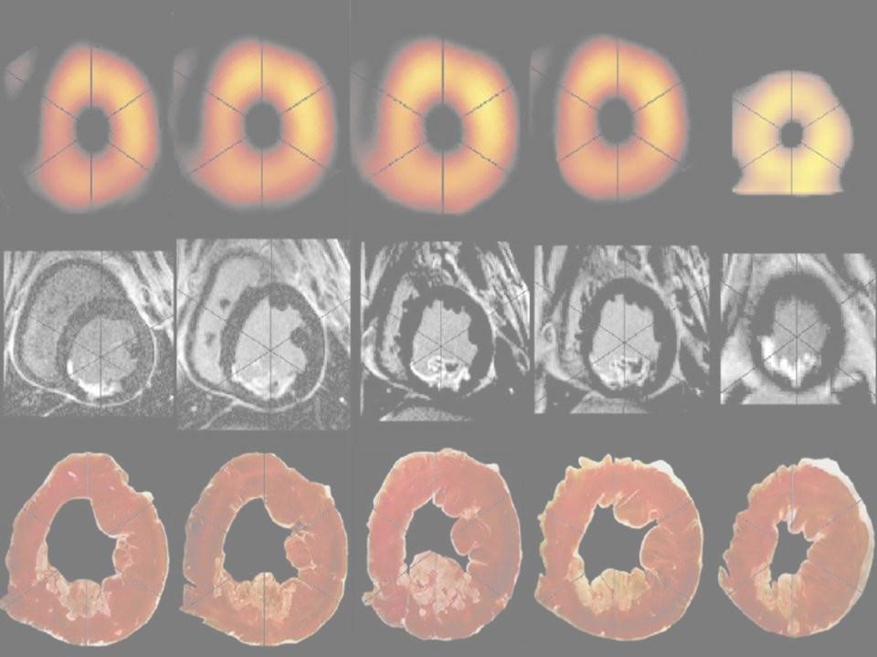 LA RISONANZA MAGNETICA CARDIACA TUTORS: S. Cukon Buttignoni, G. Nucifora, L. Pagnan, G.