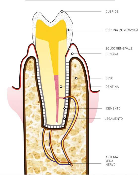 In caso però di fallimento o non praticabilità di un ritrattamento (ortogrado cioè dall alto), per tecnica inadeguata o impossibilità anatomica, l unica alternativa alla estrazione o alla rizectomia