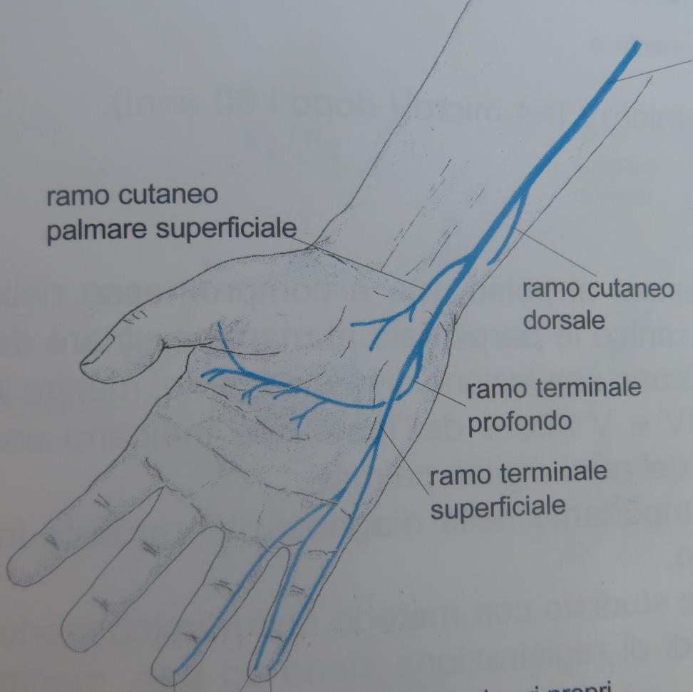 Sindrome Compressiva del Nervo Ulnare al Polso (Sindrome di Guyon) Canale di Guyon: canale delimitato da strutture ossee e ligamentose.