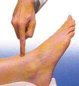 Sindrome del Tunnel Tarsale Anteriore Sintomatologia Dolore alla caviglia e al piede soprattutto notturno