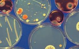 3 Patogeni e malattie infettive 9 1.4 Origine della vita e microrganismi Capitolo 2 Microscopi, colorazioni e colture 12 2.