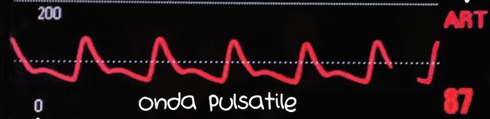 radiali presenti, due accessi venosi di grosso calibro Avvia nitrato ev, 40 mg furosemide, morfina 2 mg, si posiziona catetere (eseguiti