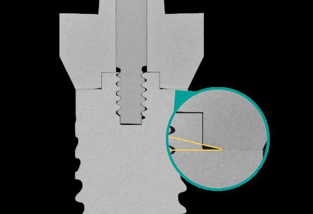 DNA biomeccanico-medicale Titanio Medicale Grado 4 Ingrandimento 80X dell impianto in titanio osteointegrato e dei suoi aspetti macro (spira e tagliente).