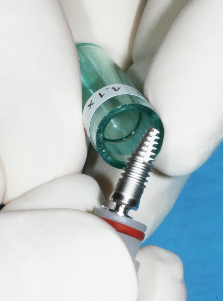 IL PACKAGING Il blister pratico e sterile consente di ottimizzare i tempi e la sicurezza della procedura