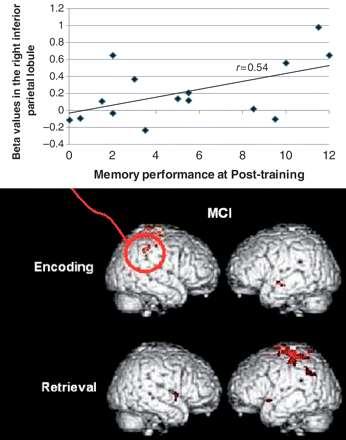 Il training mnesico induce la neuroplasticità Areas of increased brain activation after training in the MCI group: activated clusters (Posttraining > Pre-training 2) for both memory encoding and