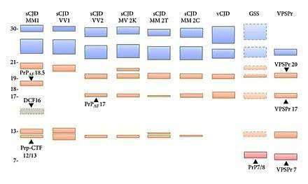 specialmente uno dal peso molecolare di 8 kda, che è considerato un tratto distintivo di questa variante (Colucci et al., 2006).