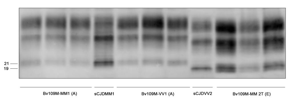 Figura 30: profilo elettroforetico della PrP Sc derivata da tessuto cerebrale di bank voles (Bv109M) infettati con i diversi tipi della scjd (campioni non deglicosilati).