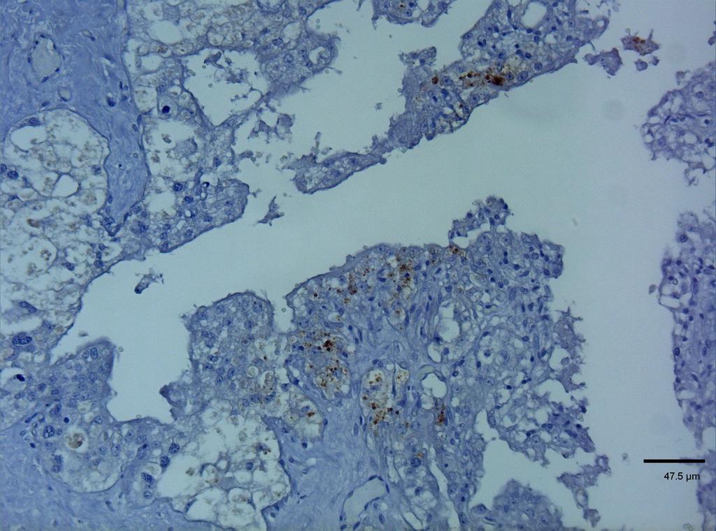 Deposizione granulare di PrPSc è osservata, in due diverse aree (A eb), a livello dell epitelio trofoblastico.