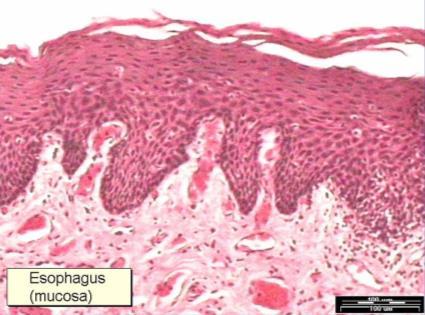 L esofago L esofago è un tubo muscolare ricoperto da epitelio